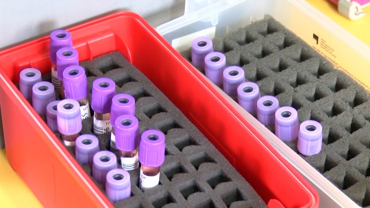 DA LI SE KRV MOŽE DOBROVOLJNO DATI NAKON PRIMLJENE VAKCINE PROTIV COVIDA- 19?