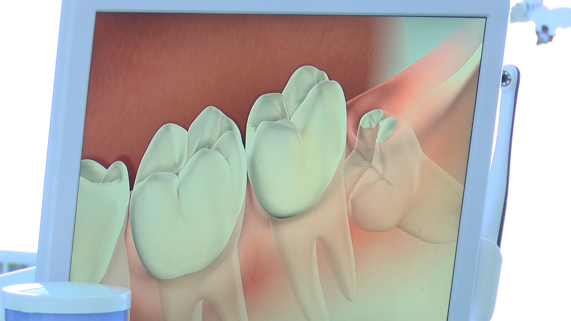 DJECA I NJEGA ZUBA: PRVA POSJETA STOMATOLOGU – KADA JE PRAVO VRIJEME?